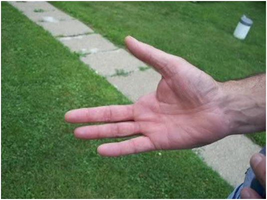 HAND